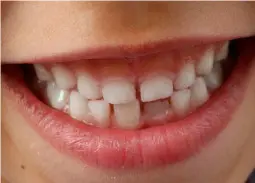 odontopediatria